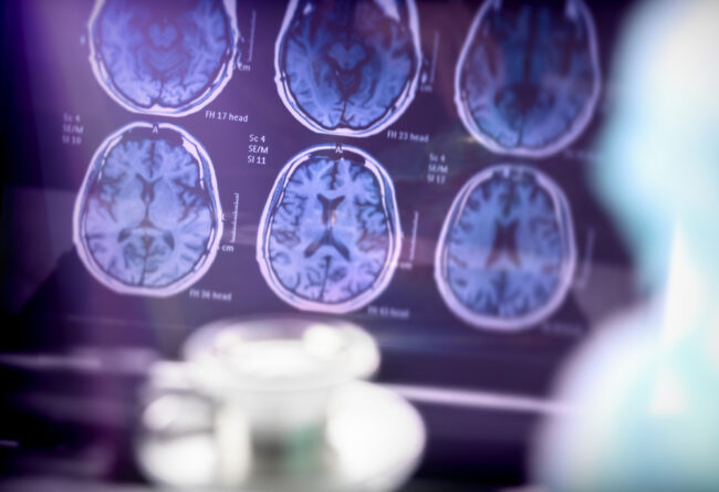 Northern Charitable Foundation - Alzheimer's research - genetics